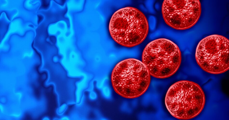 Cyclospora Outbreak Puts Food Safety to the Test
